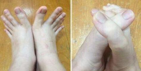 女大学生脚趾修长如手指 可以轻松用脚趾写字